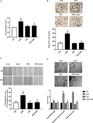 Src Plays an Important Role in AGE-Induced Endothelial Cell Proliferation, Migration, and Tubulogenesis